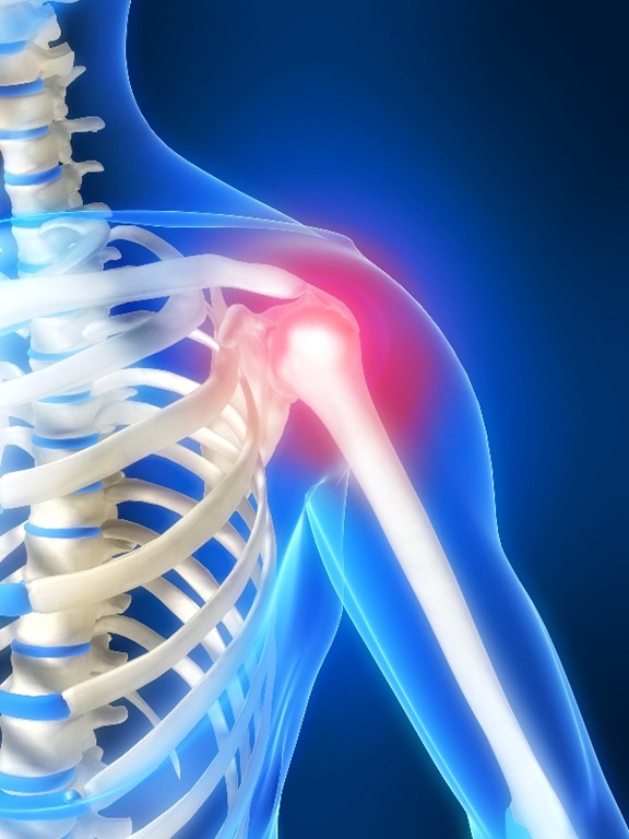Shoulder Rehabilitation Biokineticist Andries Lodder Bio4Me Shoulder Rehabilitation Biokineticist Andries Lodder Bio4Me