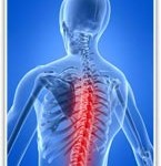 Back_Pain_Spinal_Cord_Stimulation