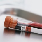 Blood Sample