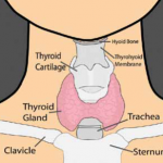 Hypothyroidism 2