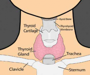 Hypothyroidism 2