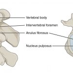 716_Intervertebral_Disk