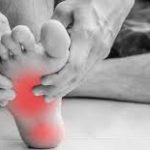 plantar fasciitis