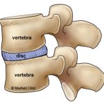 Anatomy of Vertebral Disc