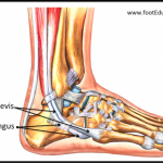 eBook-Figure-3-Tendons-of-the-peroneus-longus-and-brevis-600×371
