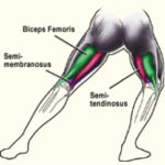 hamstring-muscle-strain1