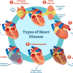 Heart-disease