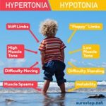 Hypertonicity-vs-Hypotonicity-2